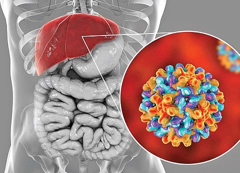 Hepatitis B