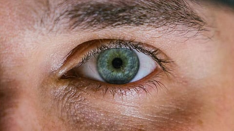 Representational image