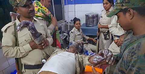 A security personnel who sustained burn injuries while trying to douse a fire in a congested alley undergoes treatment at a hospital, in  Aurangabad. (Photo | PTI)