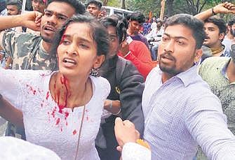 A student activist injured in caning by police at Jnana Bharathi campus