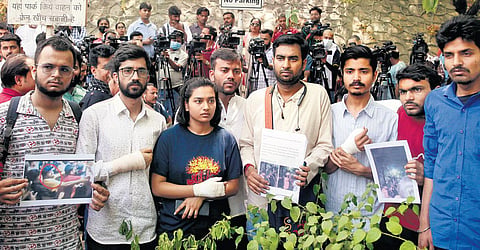 Injured ABVP students show photographs from the ‘violence’ to the media | shekhar yadav