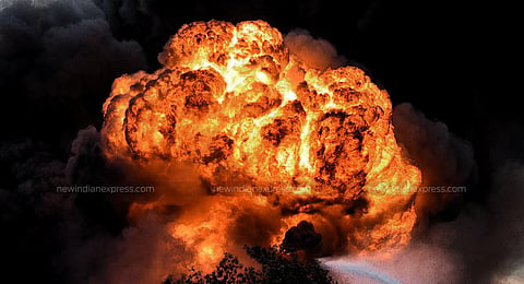 Image used for representational purpose only. (File Photo)