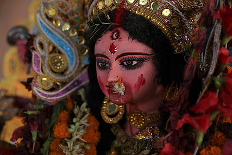 Representational Image. 