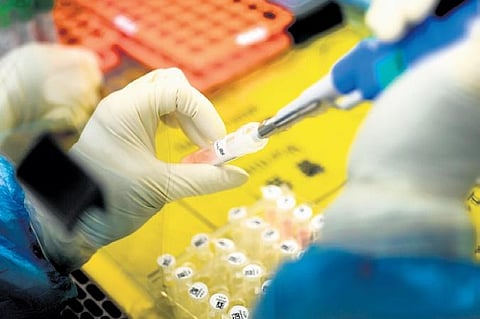 Image used for representational purpose only. (File Photo | AP)