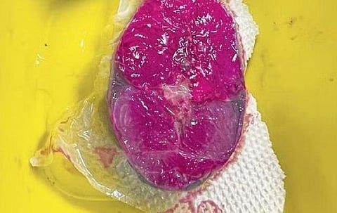 The slice of fish that was laced with formalin