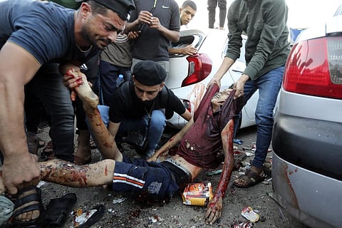 A dead Palestinian man is carried following an Israeli airstrike outside the entrance of the al-Shifa hospital in Gaza City, Friday, Nov. 3, 2023. (AP)
