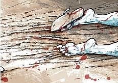 Representational Image.