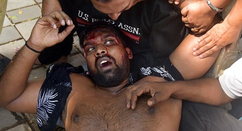 UDF Councillor Tibin Devasy injured after the police lathi resorted charge during the protest at Kochi Municipal Corporation on Monday.(Express Photo by A Sanesh)