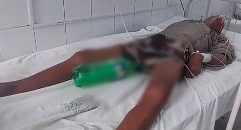The incident was reported at Jamui Sadar Hospital in Bihar. (Videograb | Twitter)