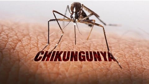Chikungunya 