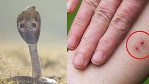 Farmer Snake Bite