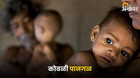 Malnutrition