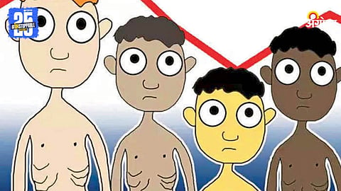 Malnutrition Issue
