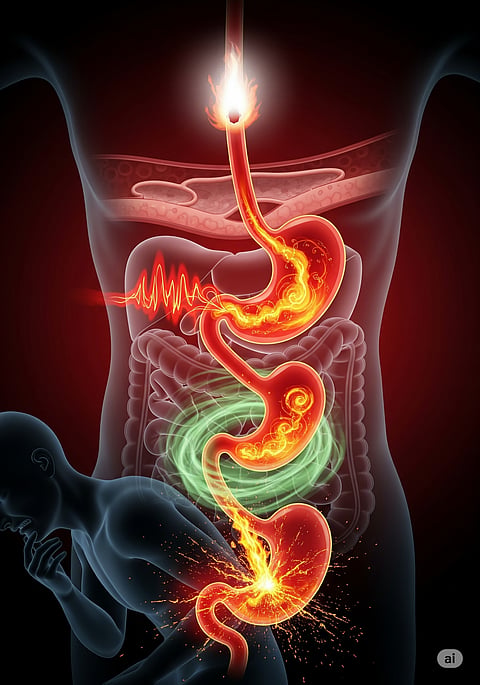 Cure Acidity Permanently