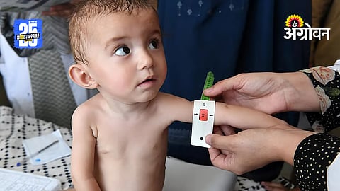 Malnutrition Crisis
