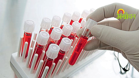 Serum Biochemistry