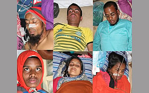 সিলেটে পটকা মাছ খেয়ে ৫ জনের মৃত্যু