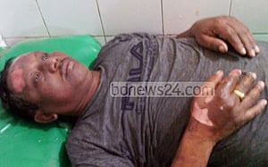 সোনার দোকানে সিলিন্ডার বিস্ফোরণে দগ্ধ ৪