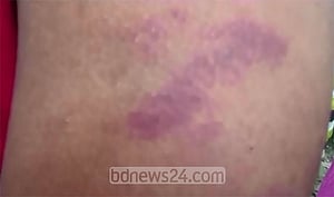 নোয়াখালীতে তরুণকে ‘বেঁধে মারধর’
