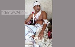 পাবনায় ব্যবসায়ীকে কুপিয়ে জখম