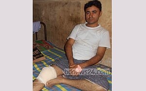 মাগুরায় কলেজ শিক্ষককে হাতুড়িপেটা