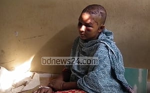 গৃহবধূকে কুপিয়ে জখম, স্বামী-শ্বশুর-শাশুড়ি গ্রেপ্তার