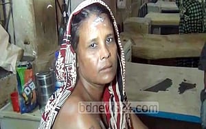 কমলগঞ্জে গৃহবধূকে এসিড নিক্ষেপ, একজন আটক