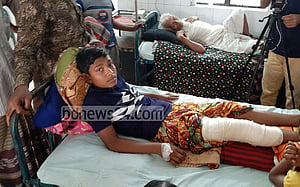 ‘কুমিরকে পিটিয়ে’ বেঁচে ফিরল বাগেরহাটের কিশোর