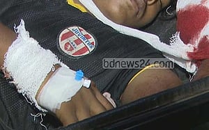 বরিশালে বিস্ফোরণে কিশোরের কব্জি বিচ্ছিন্ন