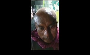 পান খেলে মাথায় ধোঁয়া: যে ব্যাখ্যা দিলেন চিকিৎসক