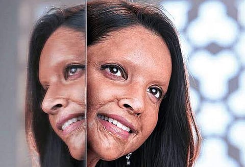 Chhapaak earns Rs. 4.77 crore on Day 1, Tanhaji leads with Rs. 15.10 crore 
