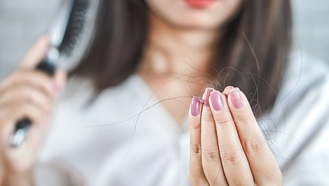 Hair Fall issues