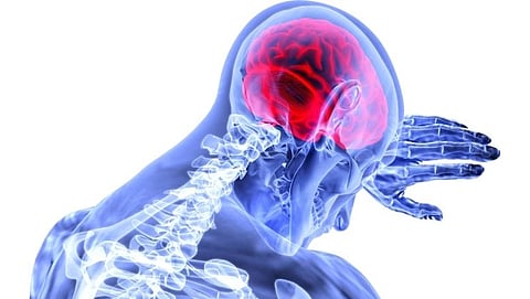 Reason's Of Brain stroke : Bad lifestyle habits can increase your risk of brain  stroke