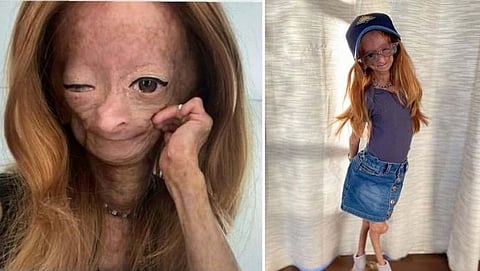 Adalia Rose