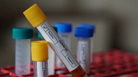 COVID-19 home testing kit 