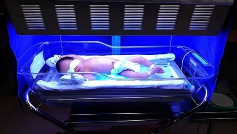what are the risk factors for jaundice in newborns know the symptoms and cure
