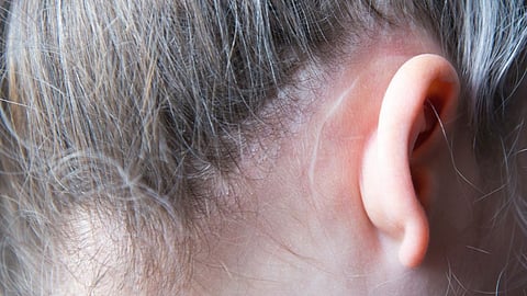 ear 
