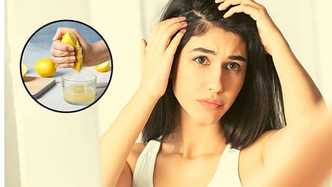 Lemon for Dandruff 