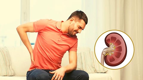 Health Tips Kidney Stone