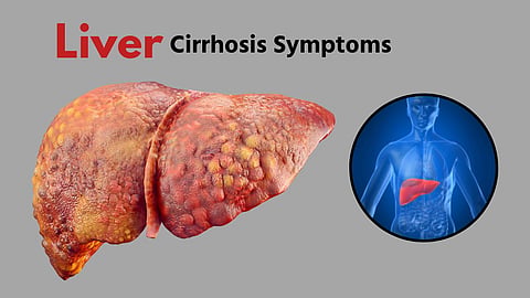 Liver Cirrhosis Symptoms | Fatty Liver Symptoms