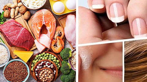 Protein Deficiency Signs