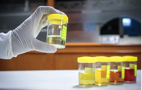 Urine & Health