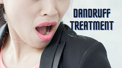 Dandruff Treatment