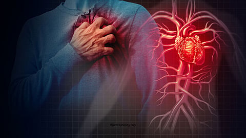 Multiple Organ Failure Diseases