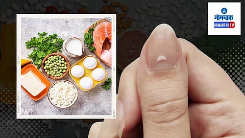 Nails Care