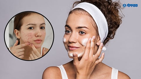 Monsoon Skin Care Tips