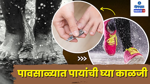Monsoon Foot Care