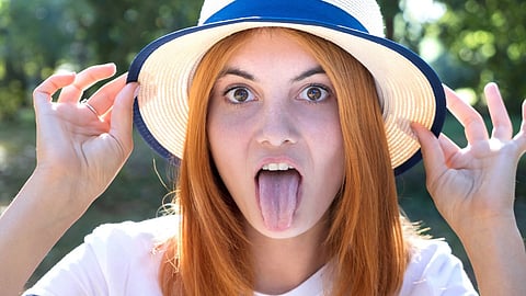 Yellow Tongue