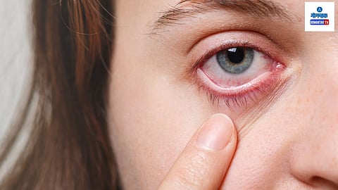 Pink Eye Care