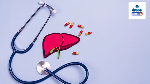 Liver Transplant